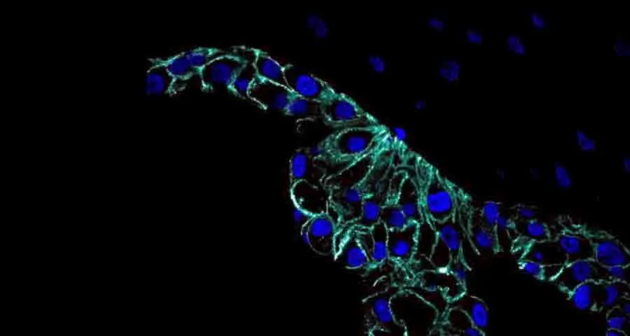 Miriam Vázquez Segoviano es EXATEC de la carrera de Ingeniería en Biotecnología en el Tec Campus Querétaro. 