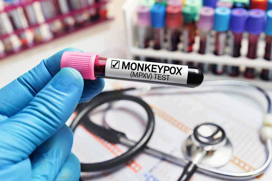 Cómo se contagia la viruela del mono