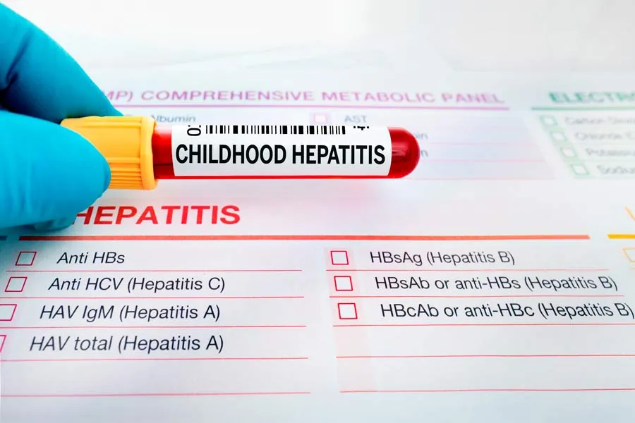 Estudios han revelado la presencia del adenovirus F41 en algunos pacientes con esta enfermedad.