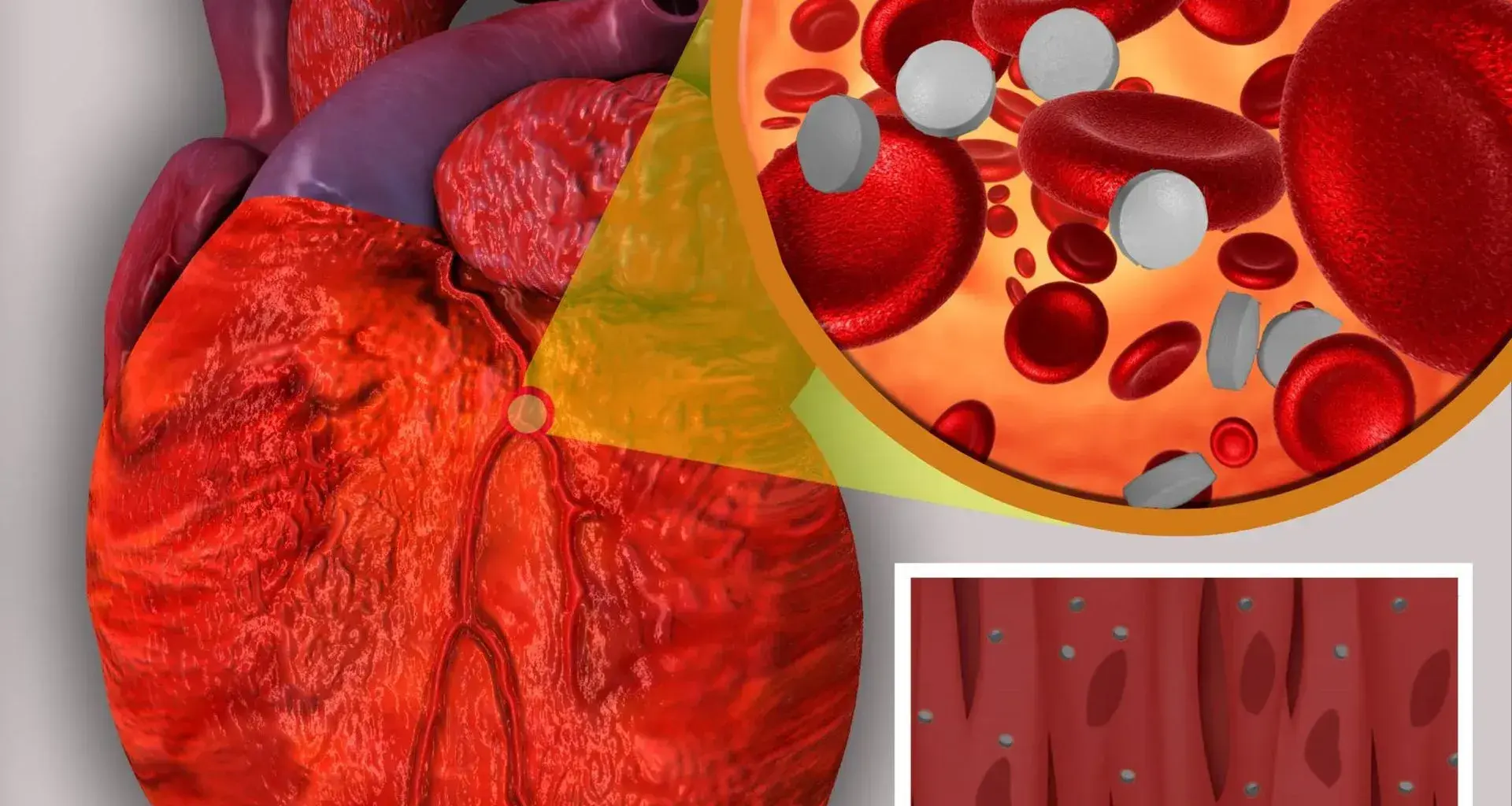 Nanomedicina en enfermedades cardiacas