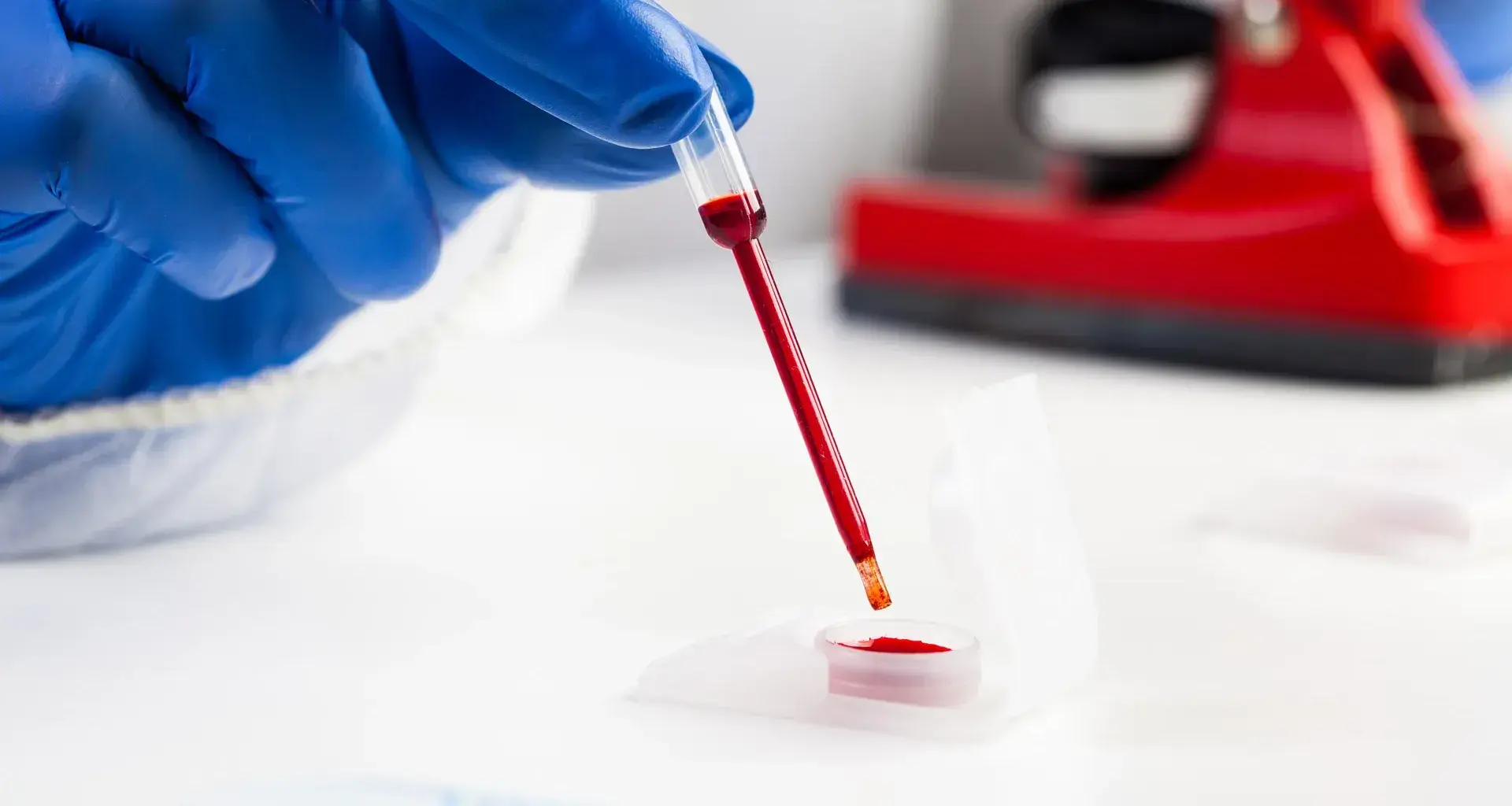 This is how plasma treatment works for patients with COVID-19