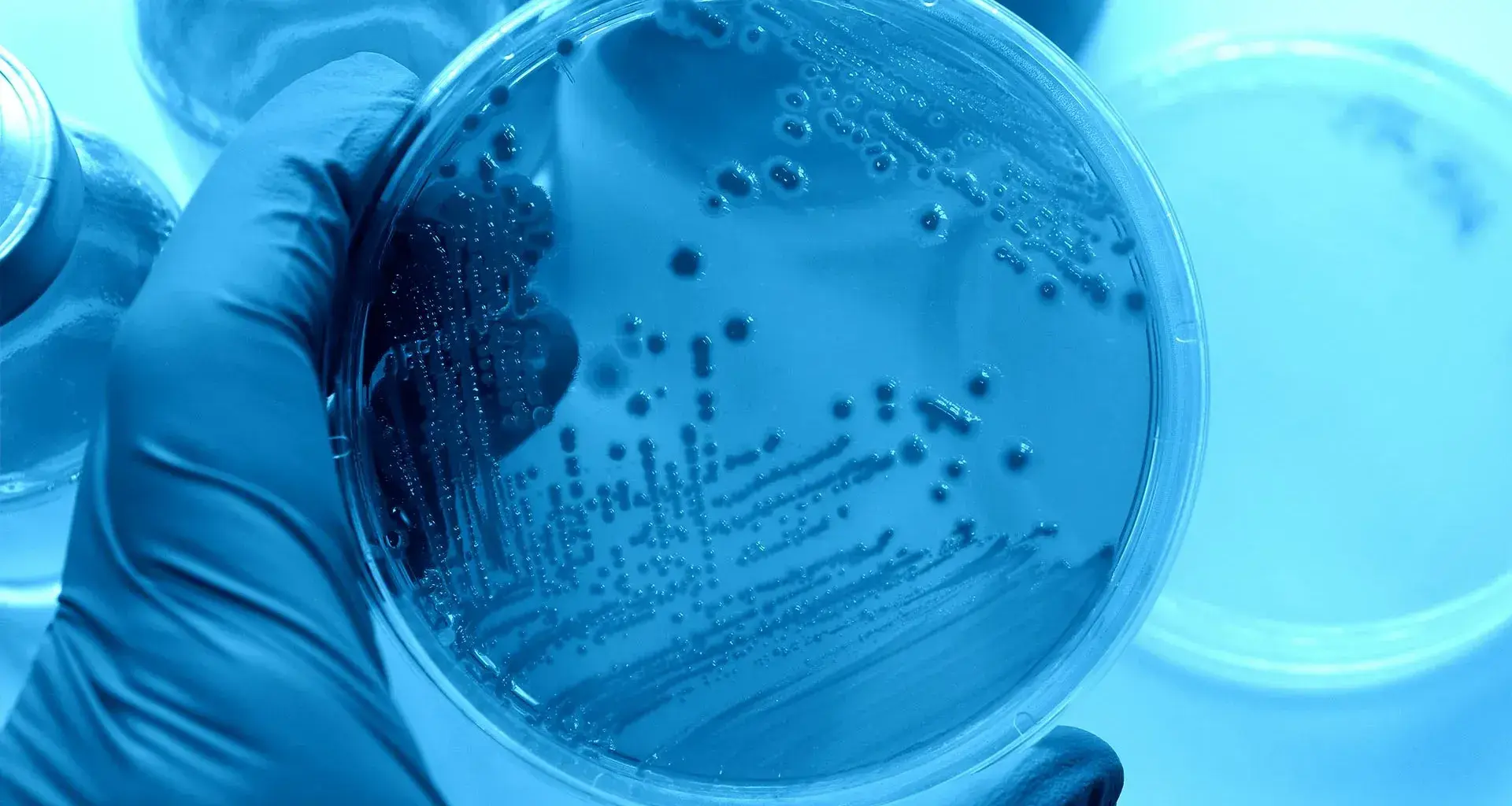 Alumno del Tec crea sanitizador para combatir virus y bacterias 