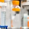 Mexicano investiga cómo reducir impacto de quimioterapias