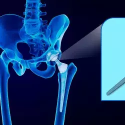 Crea sistema con realidad aumentada en cirugía de pelvis